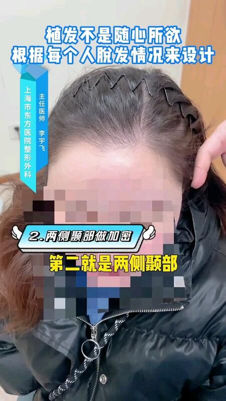 視頻封面