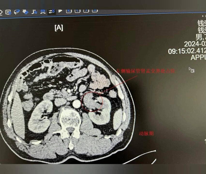 視頻封面