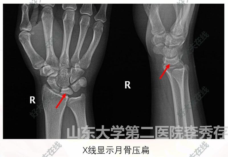 圖文圖片