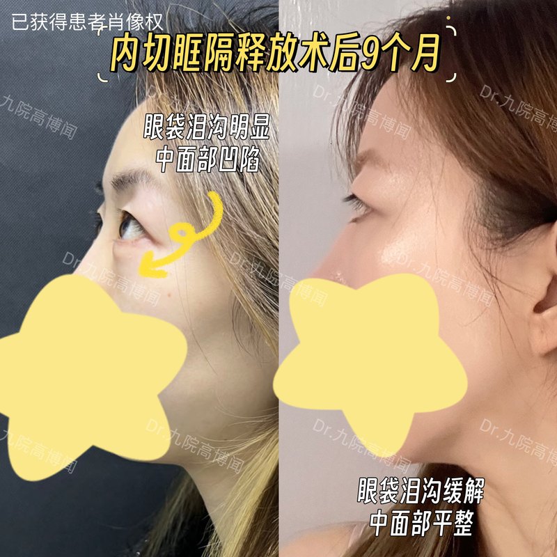 圖文圖片