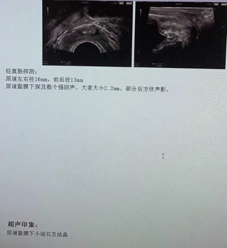 圖文圖片