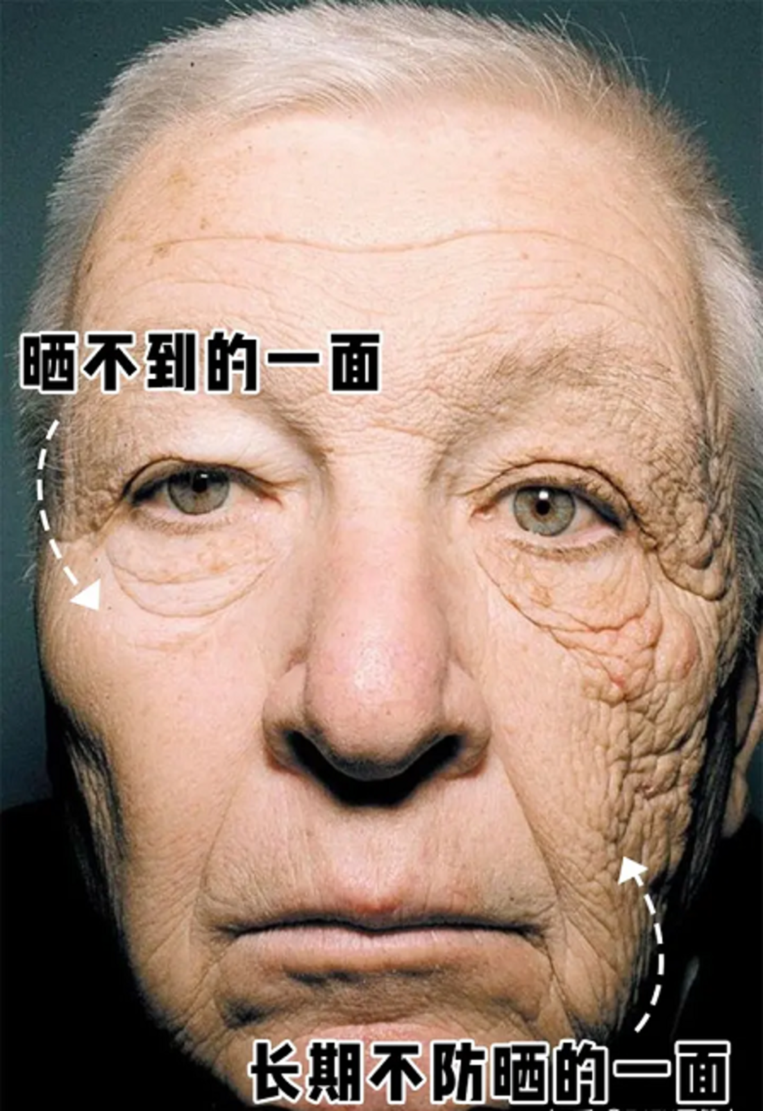 光老化对皮肤的影响图片