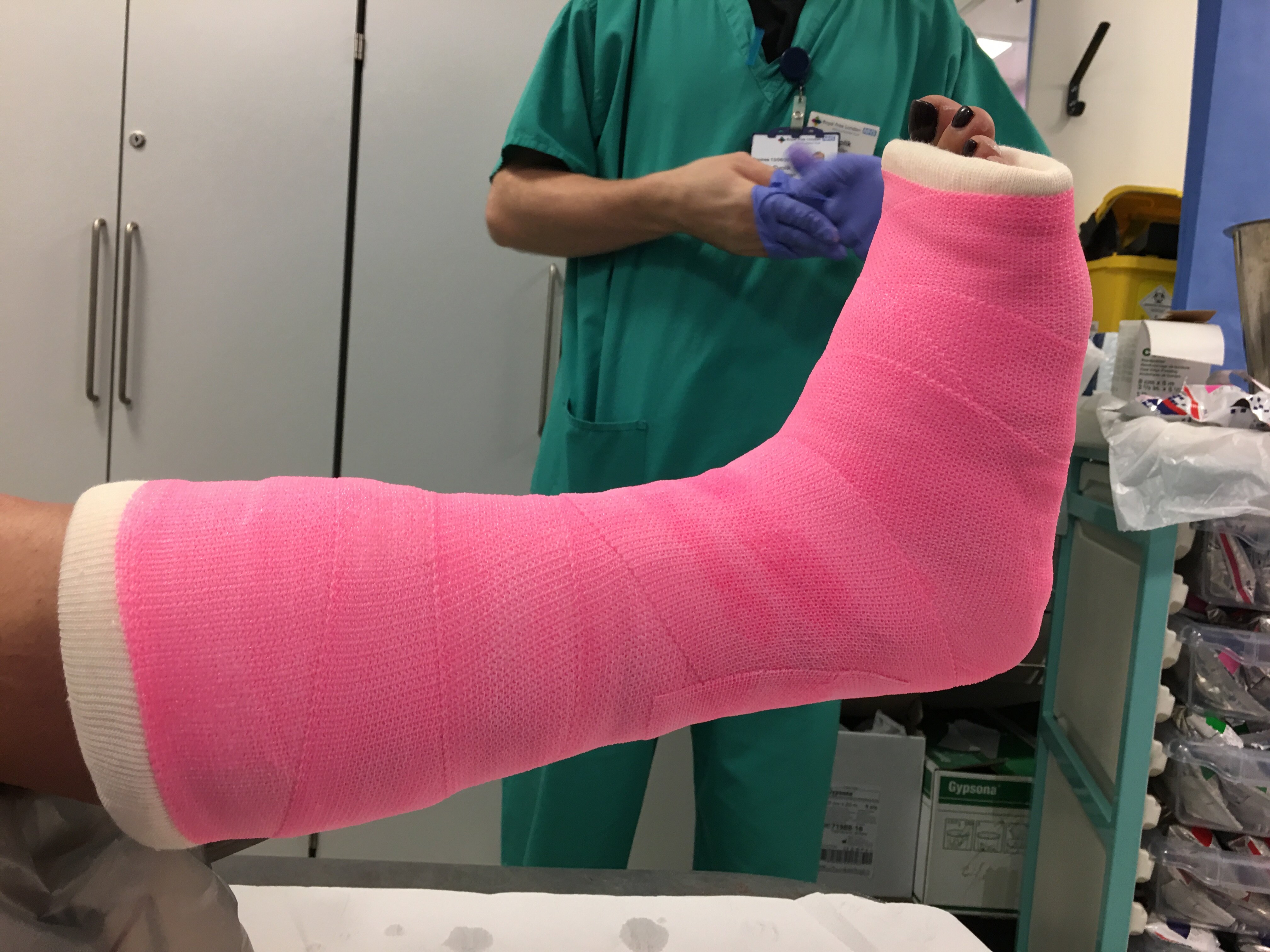 (各种颜色石膏可供病人选择,女士可能选用喜欢的粉红)在手术安排方面