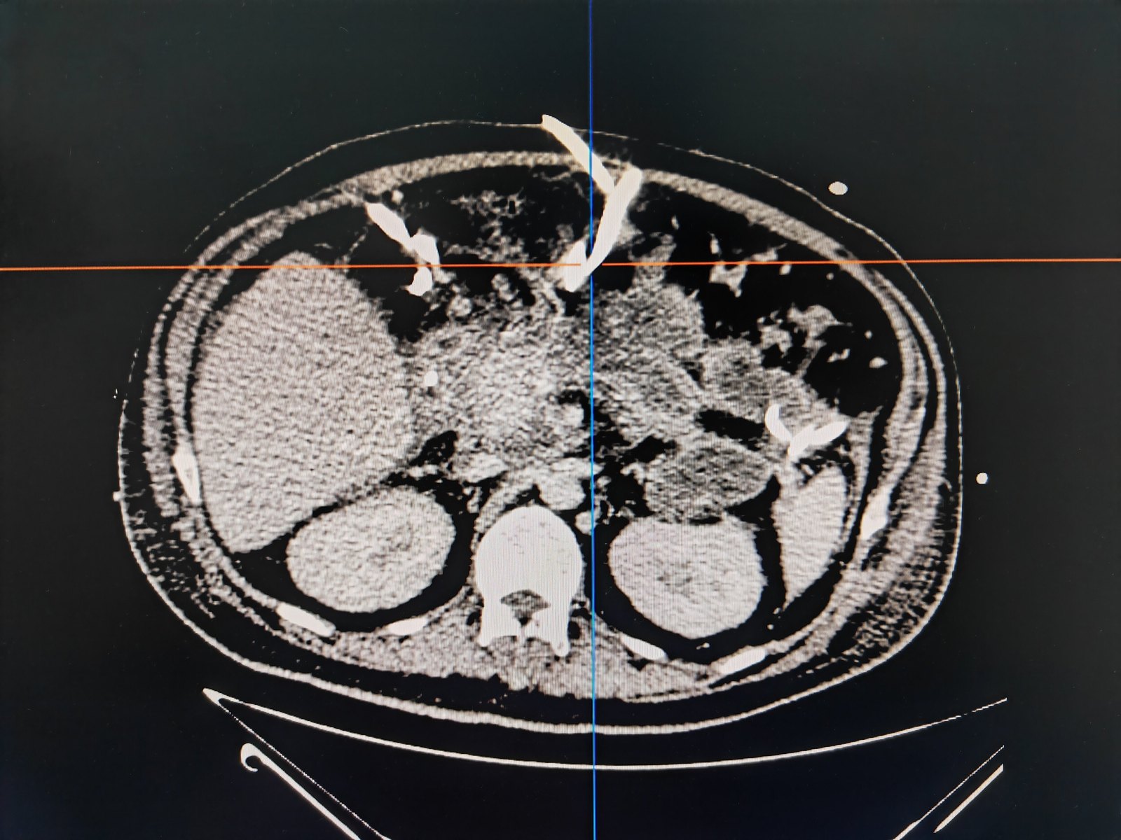 关于北京大学口腔医院预约检查陪诊挂号复杂病例整合分析,诊疗方向更明确的信息 关于北京大学口腔医院预约检查陪诊挂号复杂病例整合分析,诊疗方向更明确的信息