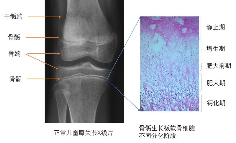 骨骺生长板软骨细胞分化.jpg