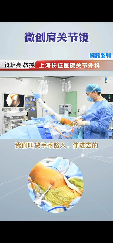 肩袖损伤，肩周炎，长期肩关节疼痛怎么办？什么是微创肩关节镜手术？