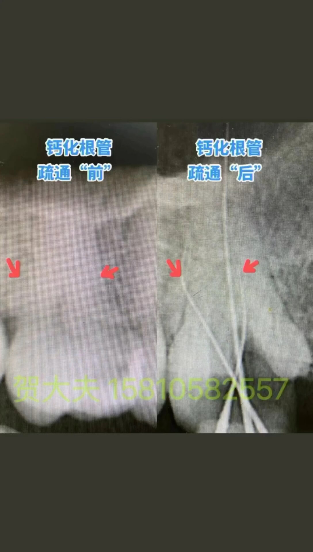 默认图片