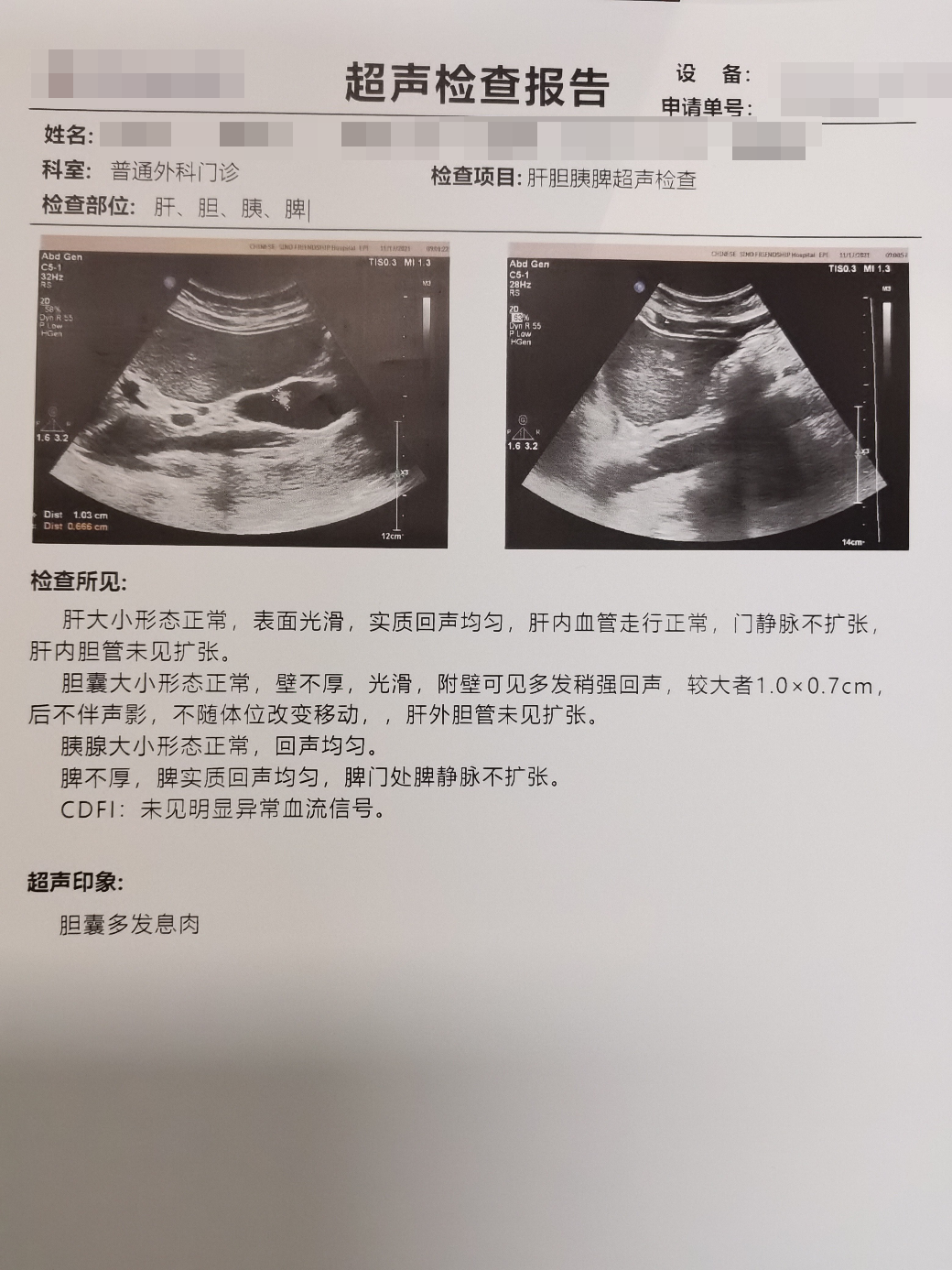 胆囊息肉样病变长到1厘米带来的焦虑 