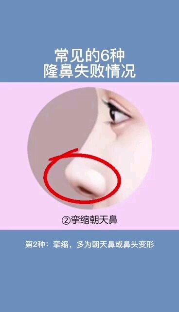 默认图片