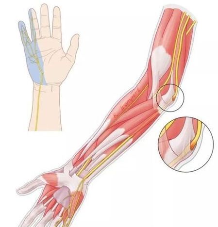 肘管综合征 - 好大夫在线