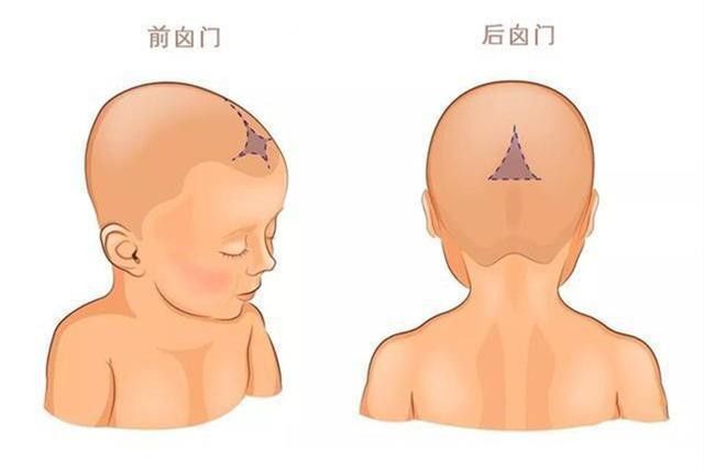 宝宝方头颅缺钙图片图片