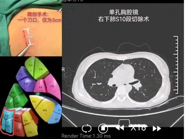 默认图片