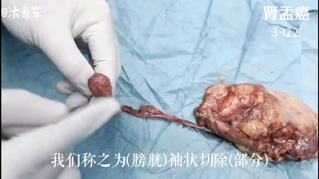 視頻封面