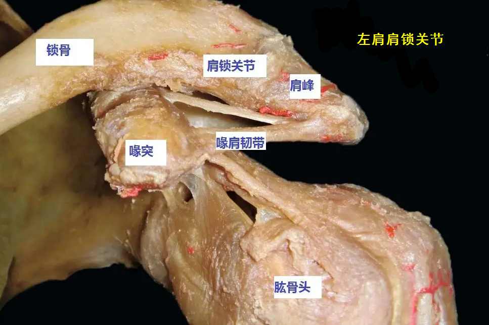 喙锁胸筋膜的结构图片