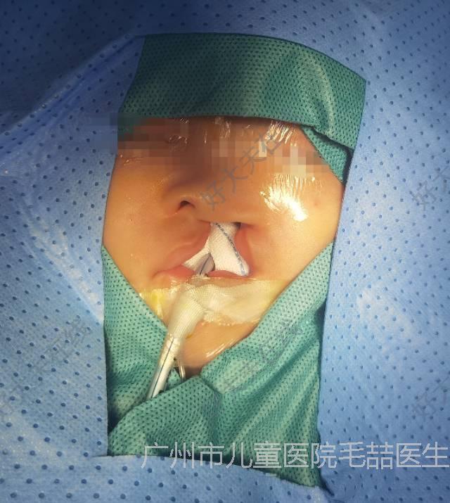 圖文圖片