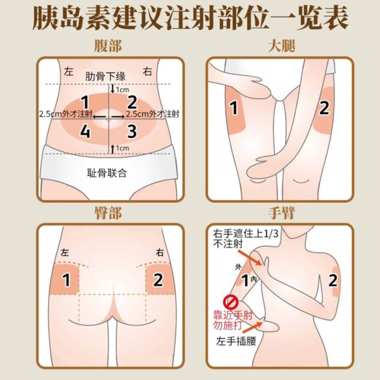 果纳芬注射部位图片