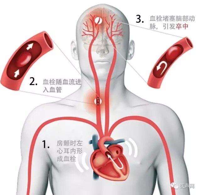 圖文圖片