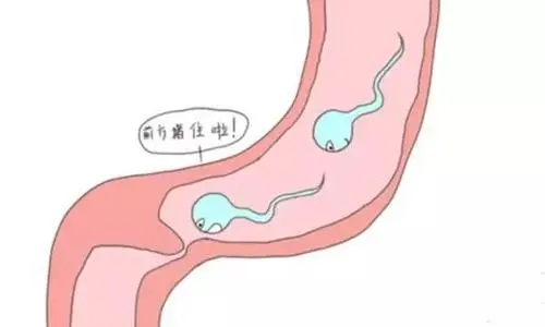 生理性射精是一个反射(射精反射),两种模式(射精和遗精),三级控制