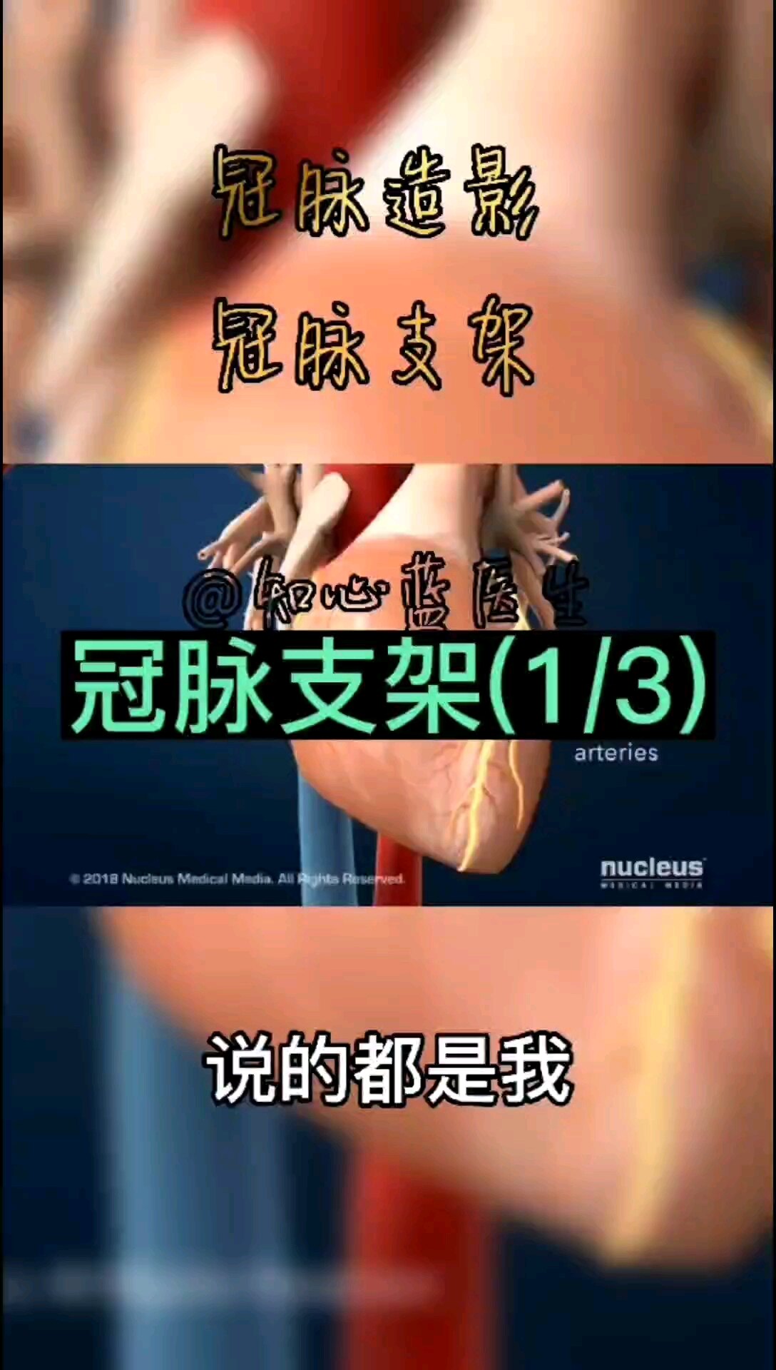 默认图片