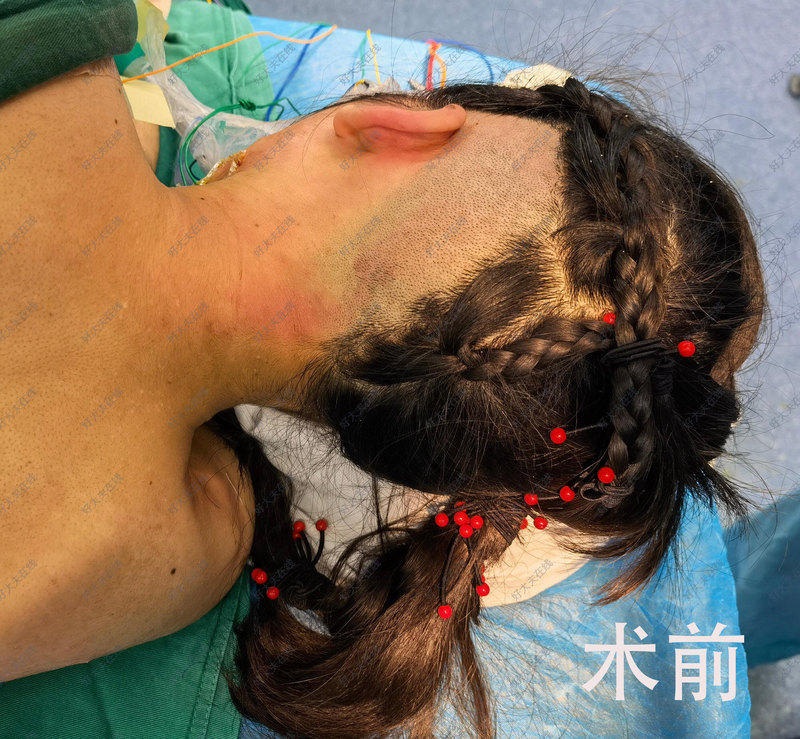 圖文圖片