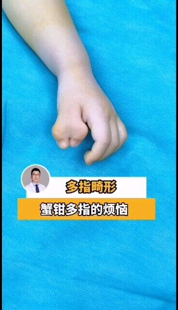 同学都叫我“蟹钳怪兽”，不要害怕！姚爸爸给你魔法变身，不久你的小手就和其他小朋友一样漂亮了！