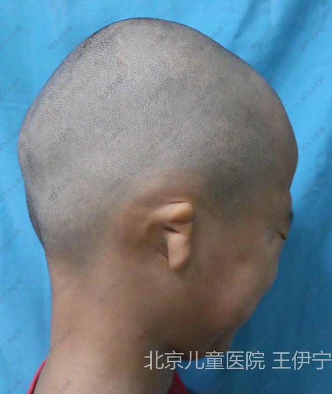圖文圖片