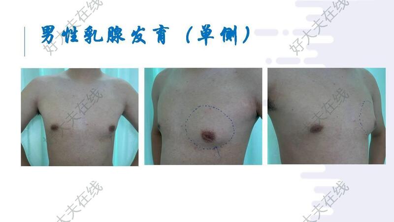 圖文圖片