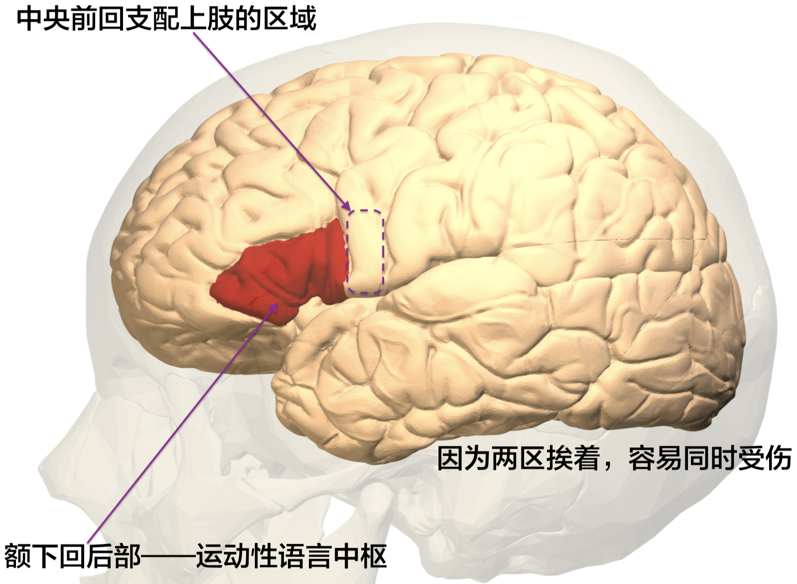 一旦损伤,患者会表现为说不出来话,同时右手不会动.