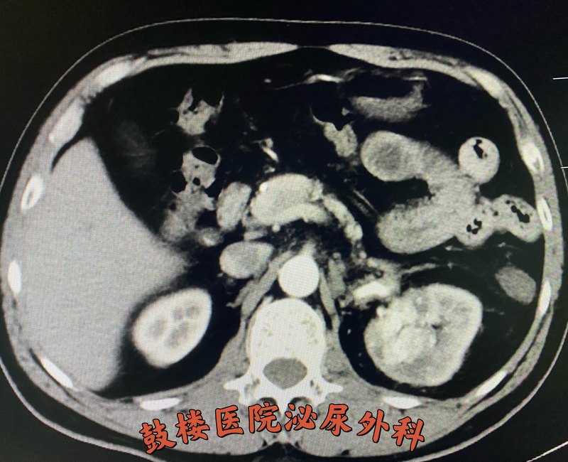 圖文圖片