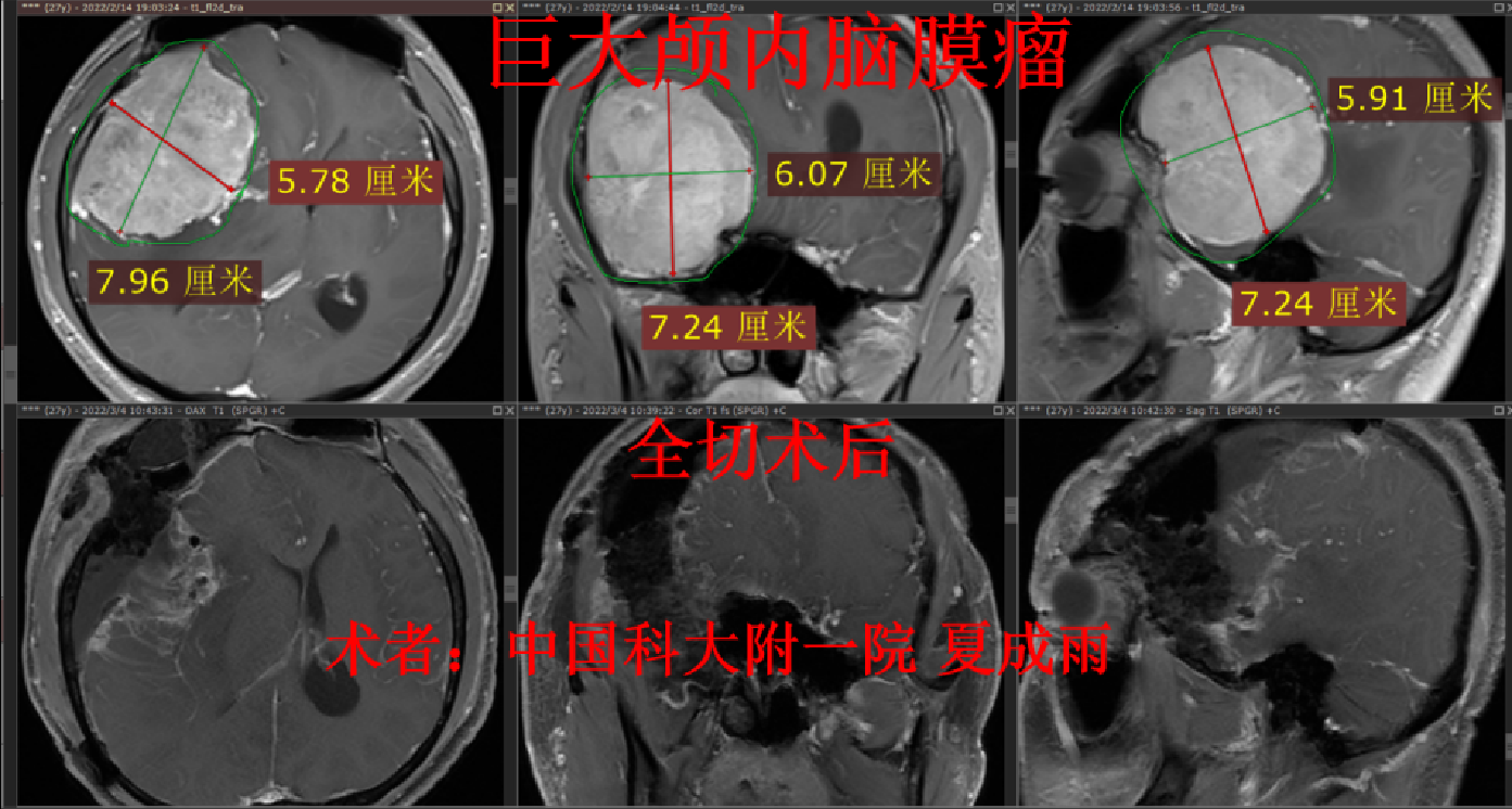 圖文圖片