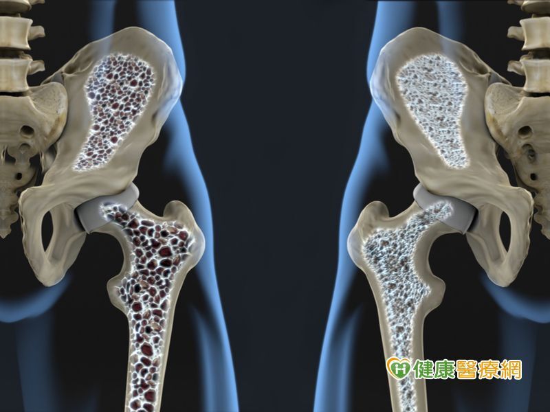 地舒单抗:骨转移患者新的治疗选择_骨转移癌_骨转移癌治疗方式 - 好