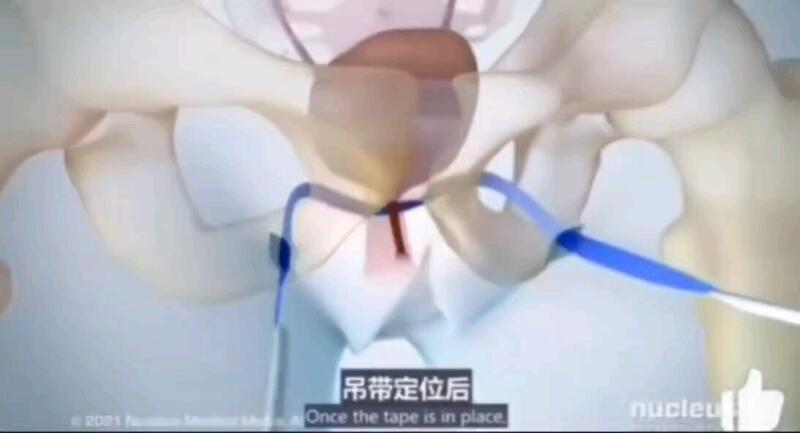 視頻封面