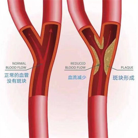 圖文圖片
