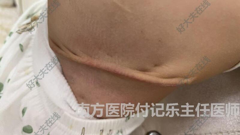 圖文圖片