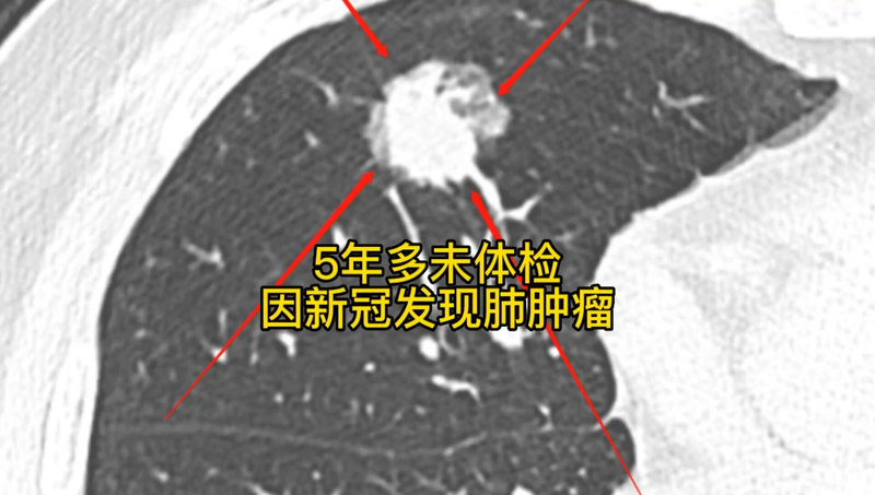 視頻封面