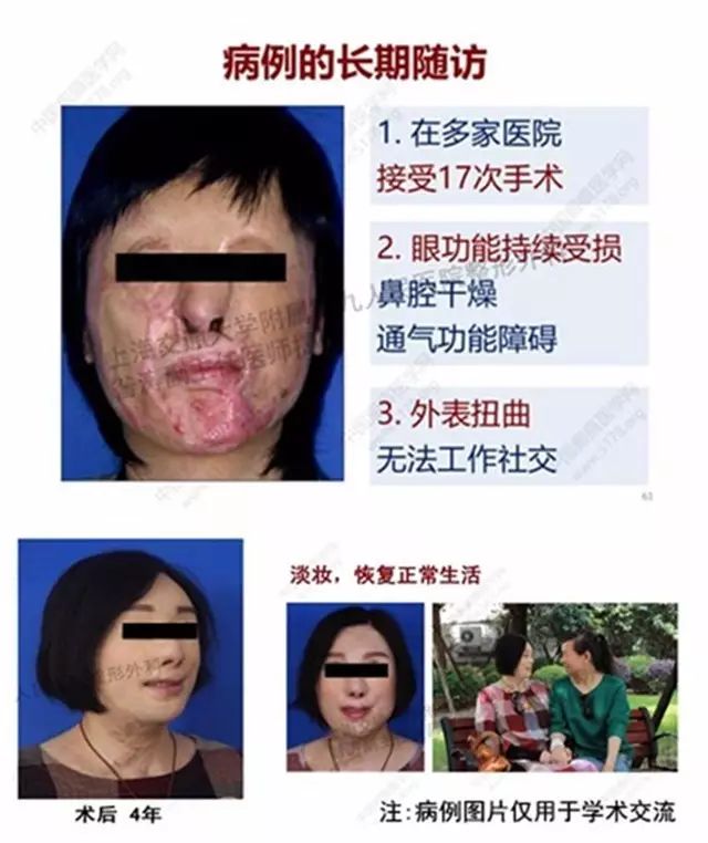 中国式换脸背后的故事