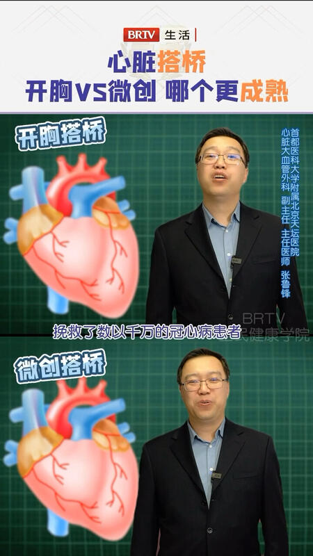 視頻封面