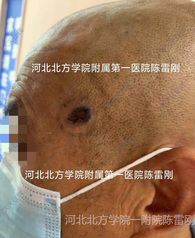 圖文圖片