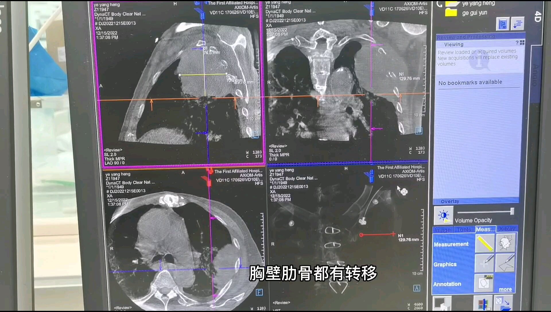 默认图片