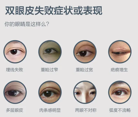 圖文圖片