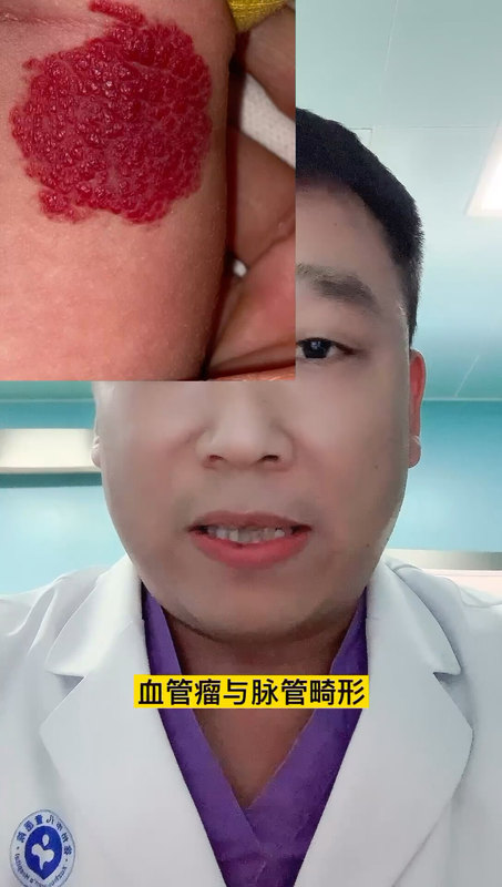 視頻封面