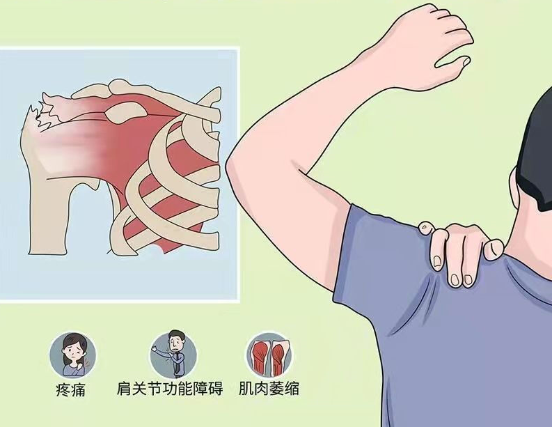 圖文圖片