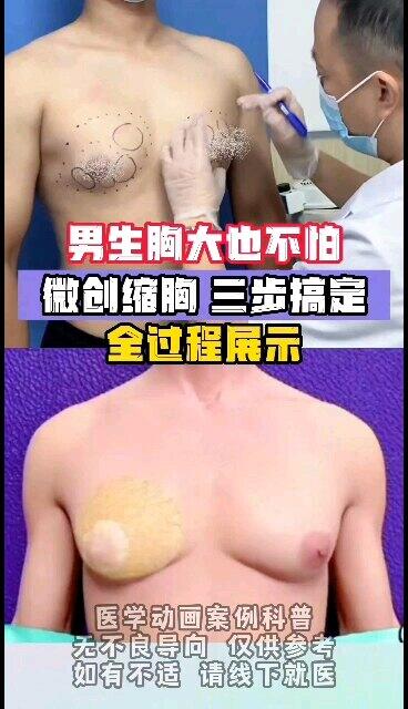 視頻封面