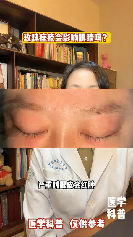 視頻封面