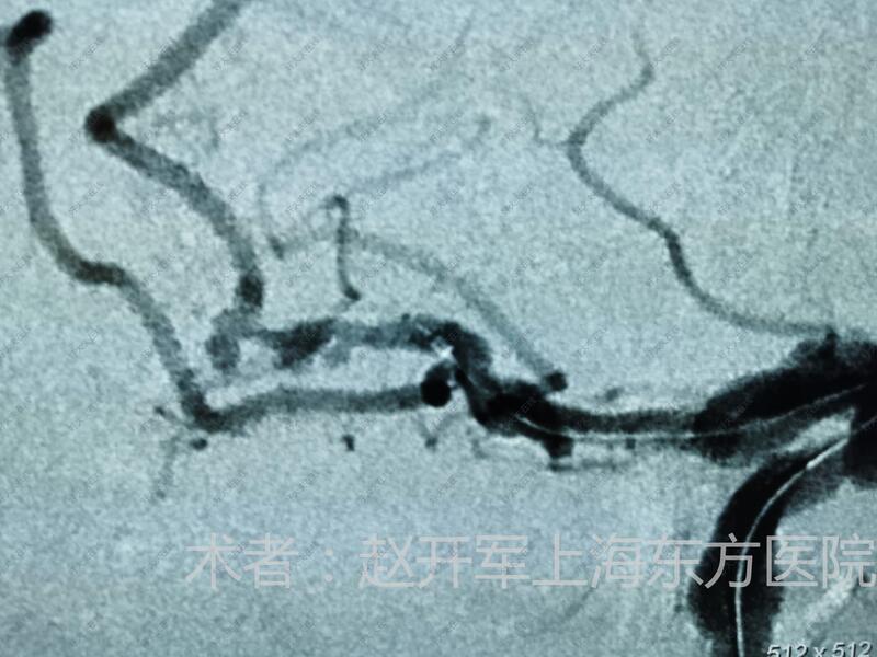 圖文圖片