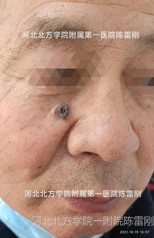 圖文圖片
