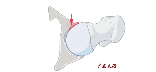 圖文圖片