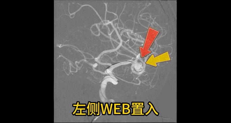 視頻封面