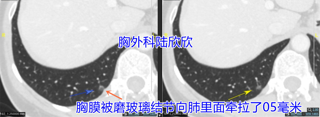 右下1薄层两张图副本.jpg