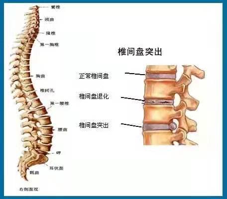 人的腰椎间盘位置图图片